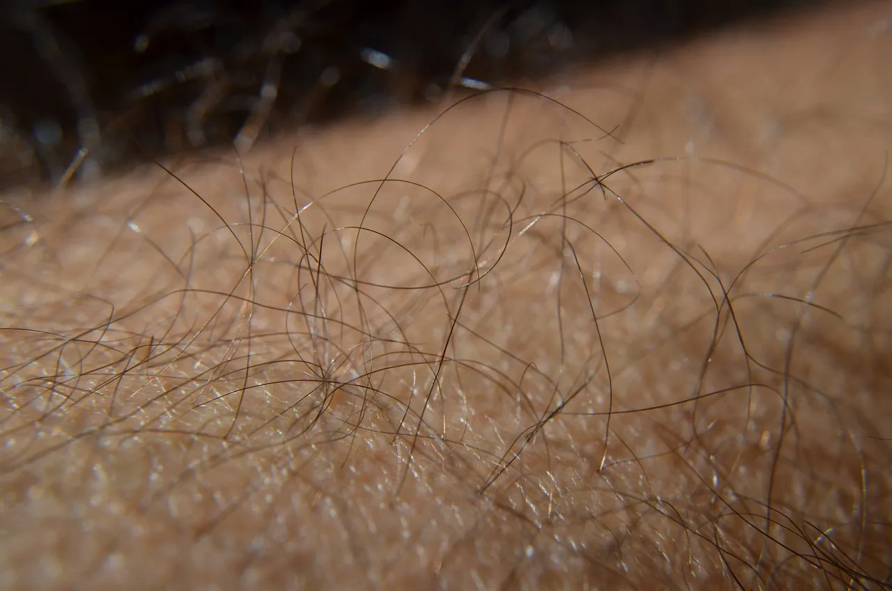 How To Remove Super Glue From The Skin